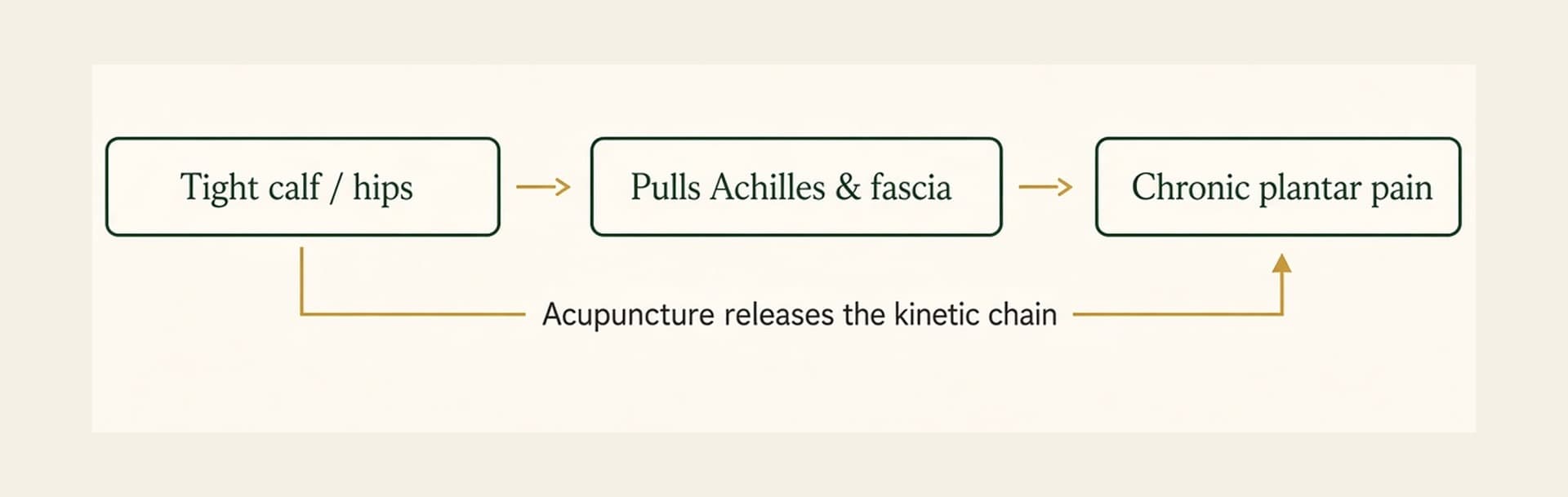 Tight calf / hips leads to Pulls Achilles & fascia, which leads to Chronic plantar pain. Acupuncture releases the kinetic chain.